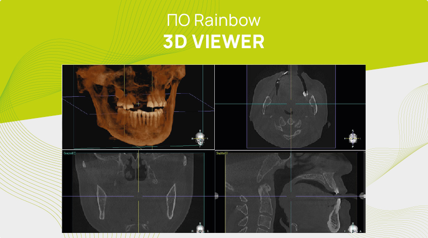 ПО Rainbow 3D Viewer